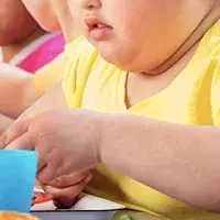 obesidad